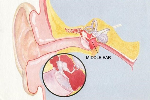 Fluid Discharge from the Ear